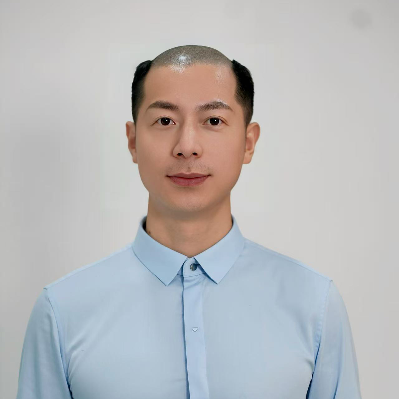 佩戴前：M 型发际线后移