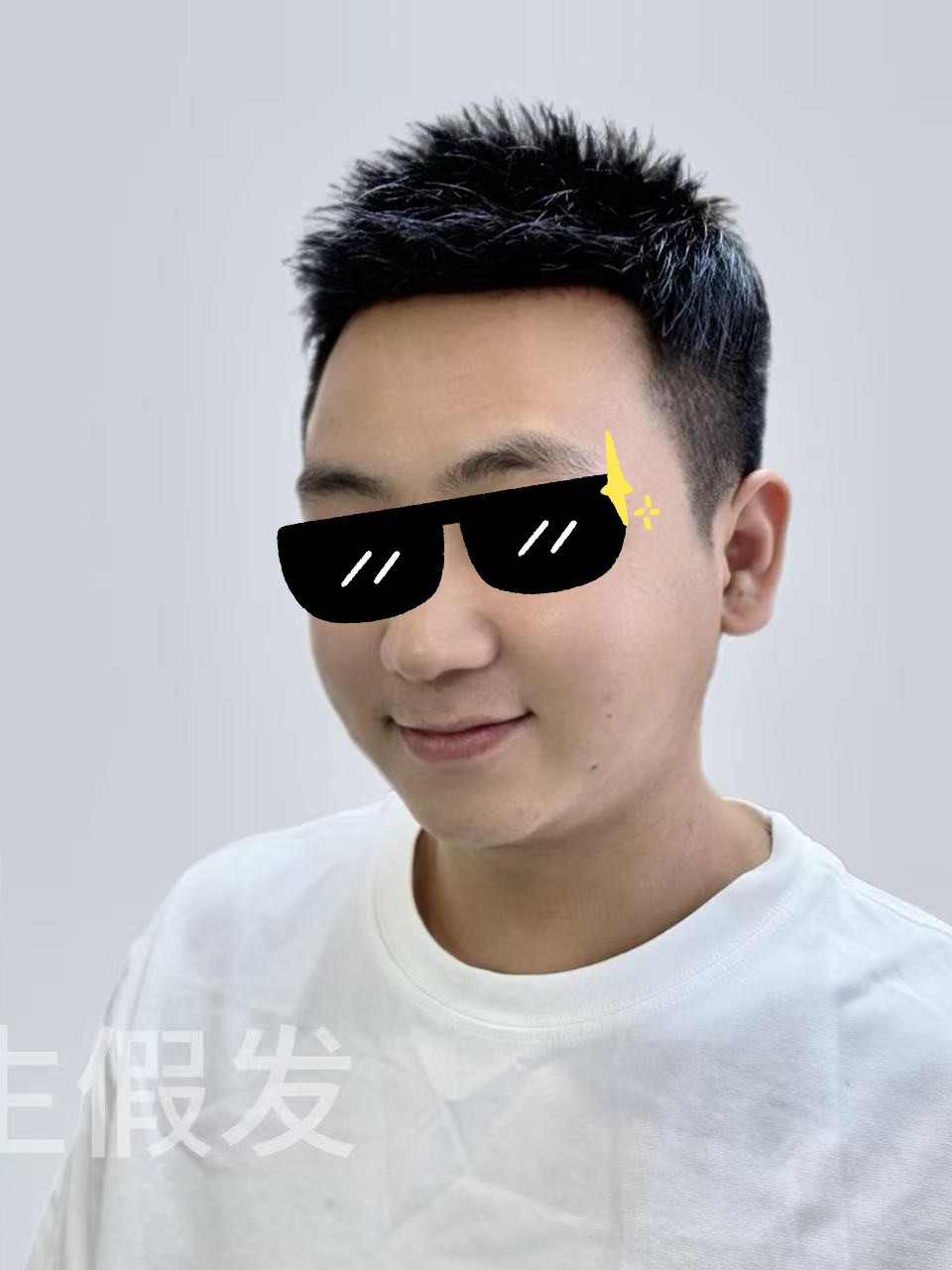 佩戴后：局部稀疏 / 斑秃